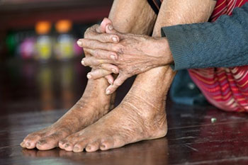 Ageing feet